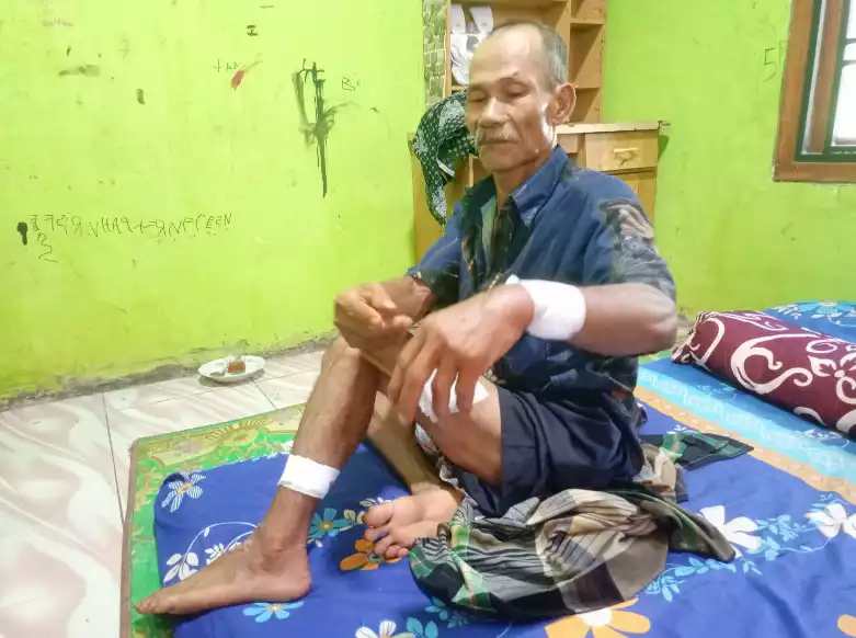 Korban Begal Tamansari Setu